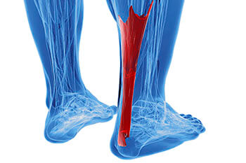 Achilles tendonitis treatment in the Marlton, NJ 08053 area