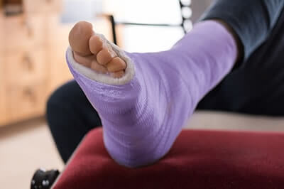 Foot Fractures treatment in the Marlton, NJ 08053 area