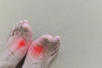 Avoiding Flare-Ups From Gout in the Feet