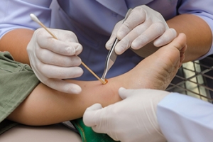 Cleaning Foot Wounds