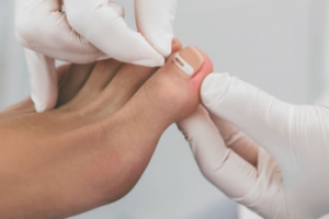 Recognizing Infection After Toenail Removal Surgery